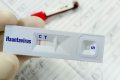 2 Kasus Suspek Hantavirus di Indonesia Sudah Dinyatakan Negatif