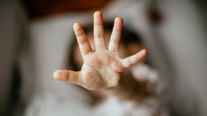 Studi: Pelecehan di Masa Kecil Berdampak pada Performa di Tempat Kerja