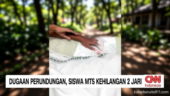 VIDEO: Diduga Jadi Korban Perundungan, Siswa MTs Kehilangan 2 Jari