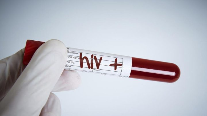 Fiji Deklarasi Darurat HIV, 1 dari 60 Orang Dewasa Positif Terjangkit